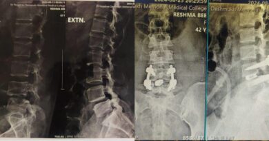 Spinal bone workshop concluded at Dr. Panjabrao Deshmukh Medical College and Hospital